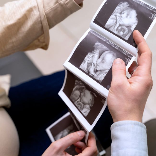 Preconception Checklist: 10 Things to Do Before Getting Pregnant